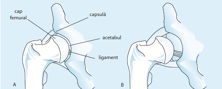 Unguent bun pentru osteochondroza gatului