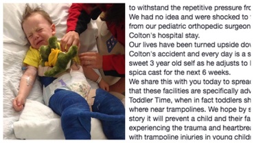 În urma experienţei traumatizante prin care a trecut băieţelul ei, o mamă avertizează: trambulinele ar trebui interzise copiilor