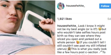 „E ca şi cum ai fost lovită de autobuz” – mesajul unei mame pentru toate cele care o judecă pentru că a ales cezariana