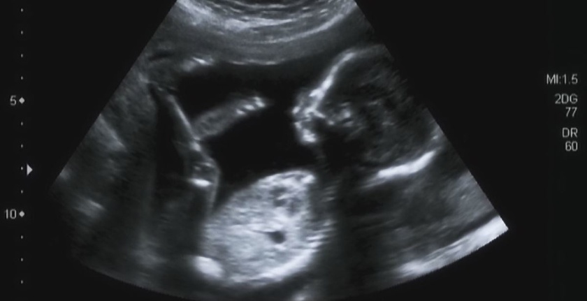 Imagini Uluitoare Ne Arată Ce Face Un Bebe Un Burtică Video