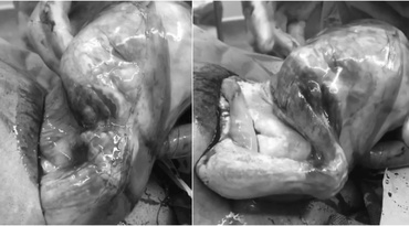 Imagini impresionante: Un bebeluş „se desface” cu propriile mânuţe din sacul amniotic