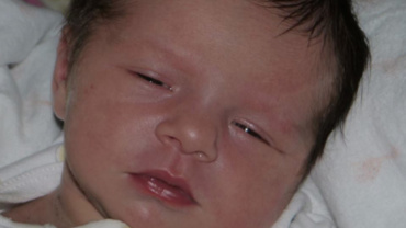 Sindromul Angelman – Afecţiunea rară din cauza căreia copilul nu doarme