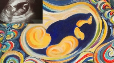 Ecografii în culori: Mama care transformă orice pântec în operă de artă