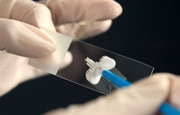 Ce este infecția cu HPV și cum o putem preveni