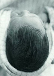 Infectia fungica a scalpului