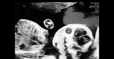 Experiment emoţionant: au filmat reacţiile apropiaţilor, la aflarea veştilor că vor avea un copil
