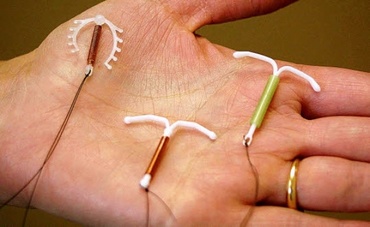Steriletul ca metodă contraceptivă. 5 motive Pro și contra