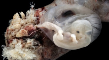 Dezvoltarea fetusului în pântecul mamei. Proiect fotografic impresionant