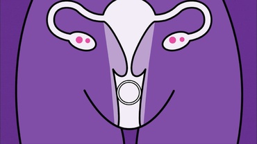 Inelul vaginal la femei. Pro sau contra?
