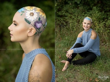 Tânără care suferă de alopecie redefinește frumusețea. Foto-portret inedite