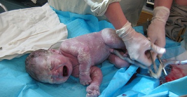 Toate maternitățile din București vor fi închise, câte o lună pe an