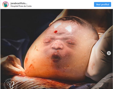 Prima respirație în afara uterului? Fotografiile virale care fac înconjurul lumii