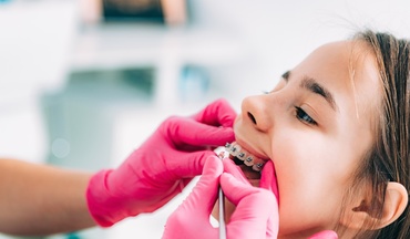 Aprobat: Elevii primesc vouchere de 1.100 de lei, bani pentru aparate dentare