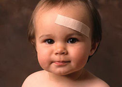 Accidente comune primei varste a copilariei