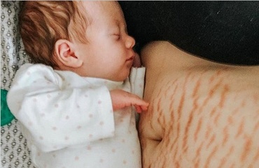 Scrisoarea emoționantă a unei mame, către corpul ei postpartum