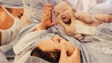 Fotografiile care ne arată că și nașterea prin cezariană poate fi la fel de frumoasă ca și nașterea naturală