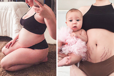 15 fotografii înainte și după sarcină, care arată miracolul nașterii