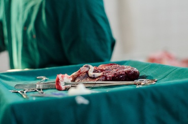 Nu vrei să ți se arunce placenta? 8 lucruri pe care le poți face cu aceasta, după naștere