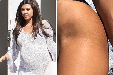 Mămicile celebre care sunt mândre de corpul lor postpartum