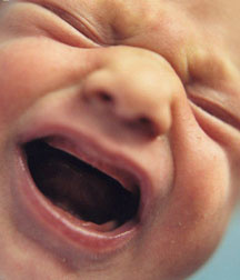 Lovituri ale gingiilor si dintilor