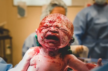 15 fotografii uimitoare de la nașterea prin cezariană, care arată cât de puternice sunt mamele