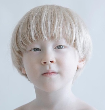 Wow! Un fotograf surprinde frumusețea unică și uimitoare a copiilor cu albinism