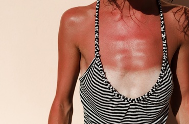 8 mituri despre loțiunile cu SPF, explicate de medicii dermatologi