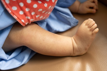 Petechiae la bebeluși: cauze, simptome și tratament