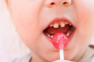 Top 3 cele mai frecvente probleme dentare la copii, în sezonul cald