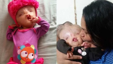 Nu, copilul meu nu este un extraterestru! Fetița mea este o luptătoare care merită o șansă