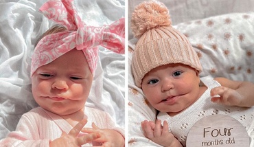 Ayla, fetița care zâmbește mereu, a impresionat pe toată lumea cu afecțiunea ei genetică rară