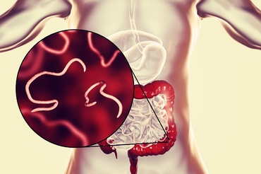 Infecția parazitară cu oxiuri, la copii. Tot ce trebuie să știi despre ea