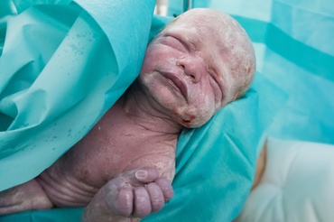Ce este vernix caseosa și ce rol are în protejarea bebelușului