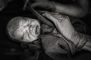 TOP cele mai bune fotografii de naștere, care arată extazul, agonia și magia nașterii