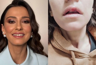 Dana Rogoz, de urgență la spital, din cauza unui incident stupid: „Am fost cusută”