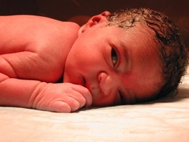 Icterul la nou nascuti tratament