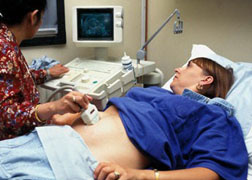 Sarcina extrauterina