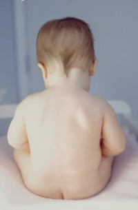 Criptorhidia sau anomalia pozitionarii testiculului