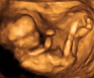 Saptamana 12 de sarcina