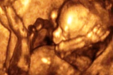 Saptamana 16 de sarcina