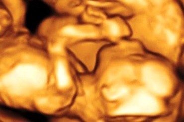 Saptamana 17 de sarcina