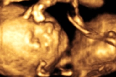 Saptamana 18 de sarcina