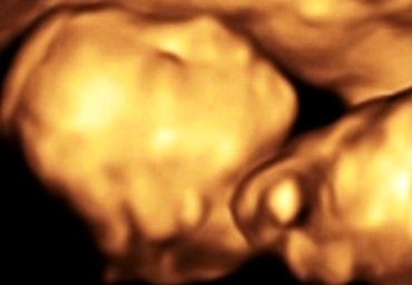 Saptamana 19 de sarcina