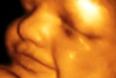 Saptamana 20 de sarcina