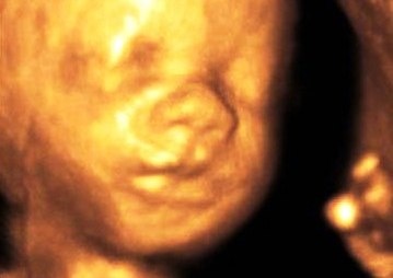 Saptamana 26 de sarcina