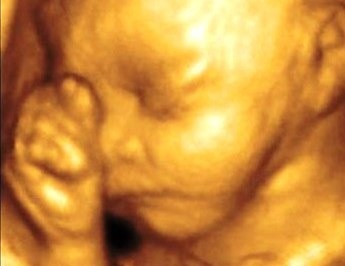 Saptamana 28 de sarcina