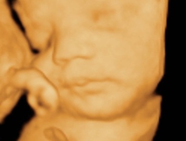 Saptamana 32 de sarcina