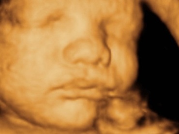 Saptamana 34 de sarcina