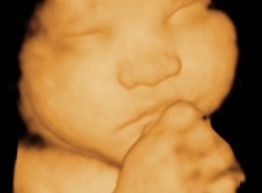 Saptamana 35 de sarcina