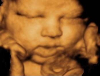 Saptamana 37 de sarcina